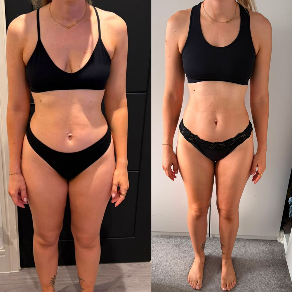 Transformation 1